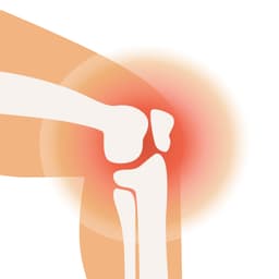 Arthritis