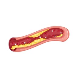 Cholesterol